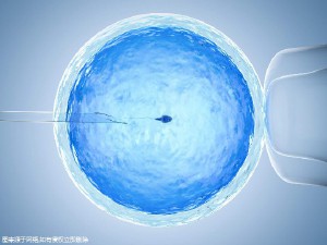 主案例